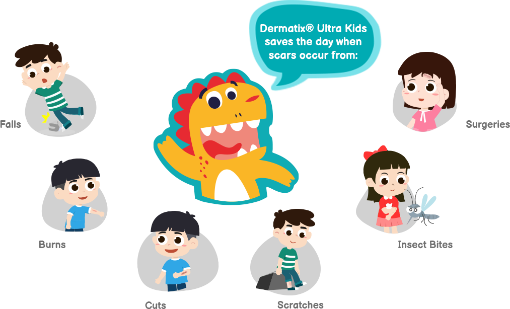Dermatix® Ultra Kids saves the day when scars occur from: Falls, Burns, Cuts
Scratches, Insect Bites, Surgeries